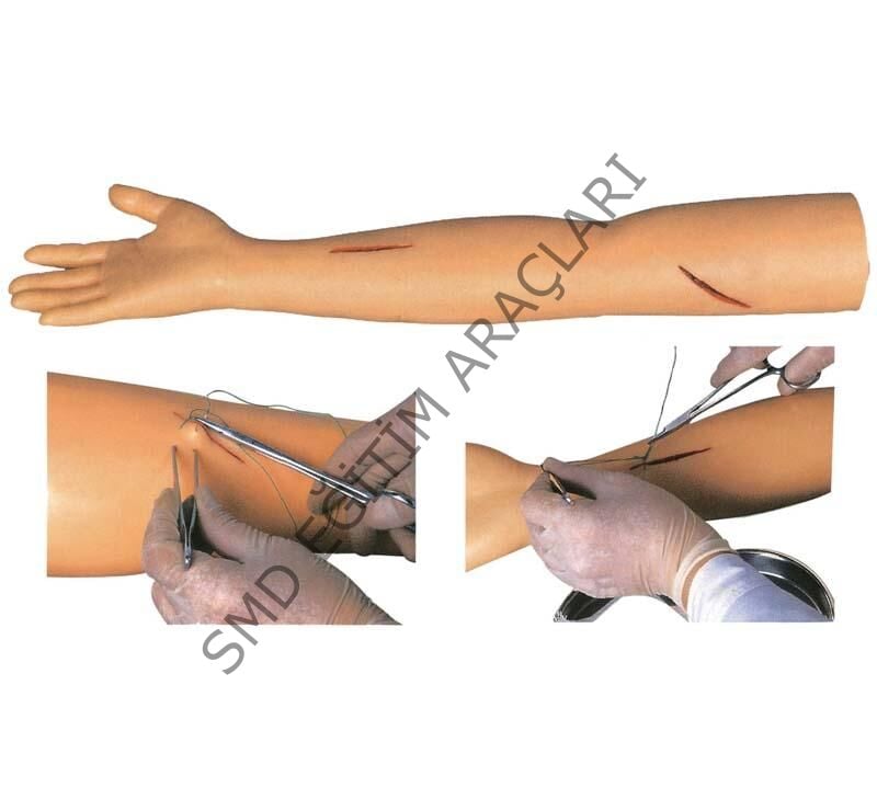 KOL SÜTÜR UYGULAMA MAKETİ