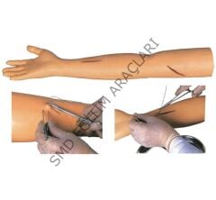 KOL SÜTÜR UYGULAMA MAKETİ