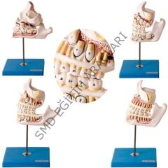 DİŞ GELİŞİM SETİ 4 PARÇA